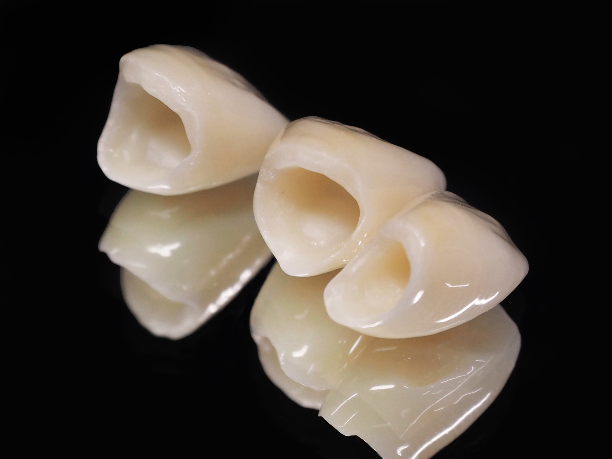 欠けた歯の修復や虫歯治療の仕上げにもこだわっています